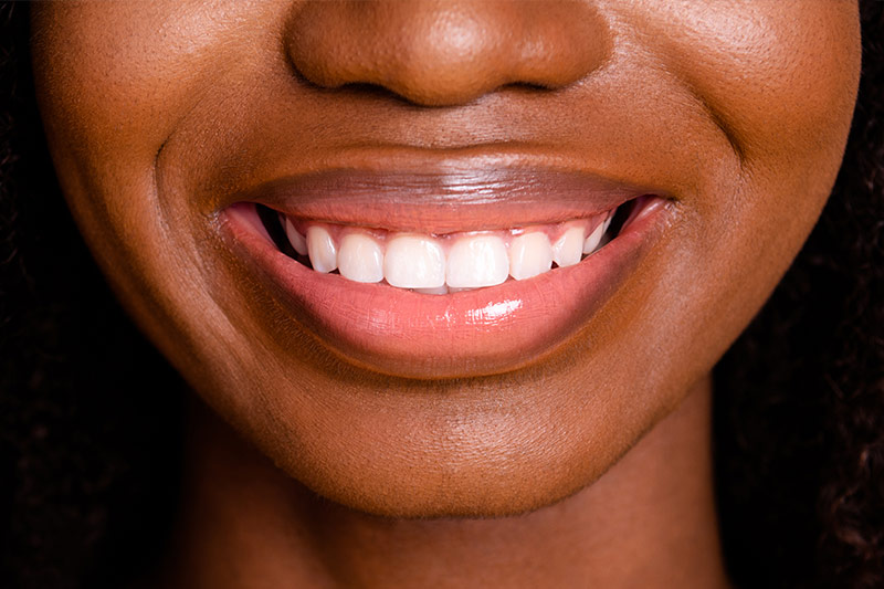3D Cat Scan for Dental Implant Placement in Altamonte Springs