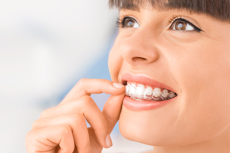 Dental Treatments in Altamonte Springs