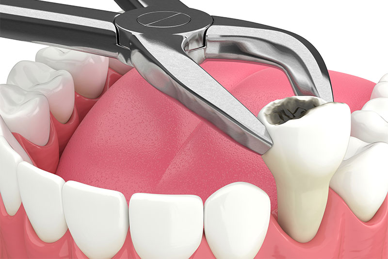 Quality Dental Treatments in Altamonte Springs