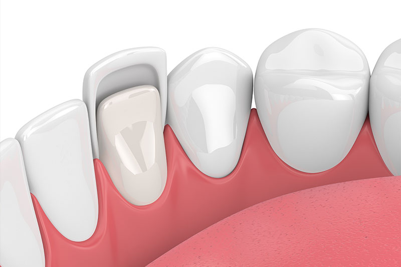 Dentist in Altamonte Springs