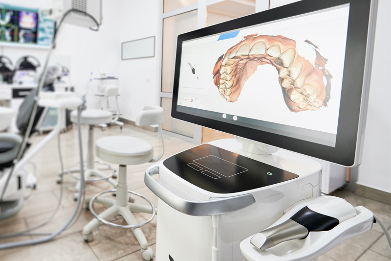 3D Intraoral Scanner Itero Lumina Specializing in Invisalign in Altamonte Springs