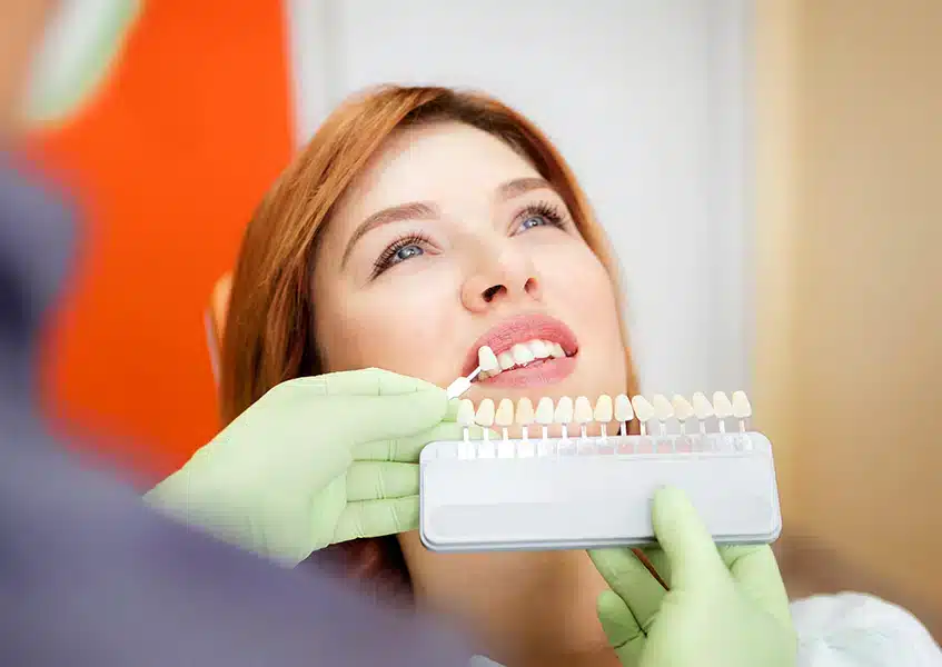 Veneers - Dental Services in Altamonte Springs, FL - Darley Dental Care