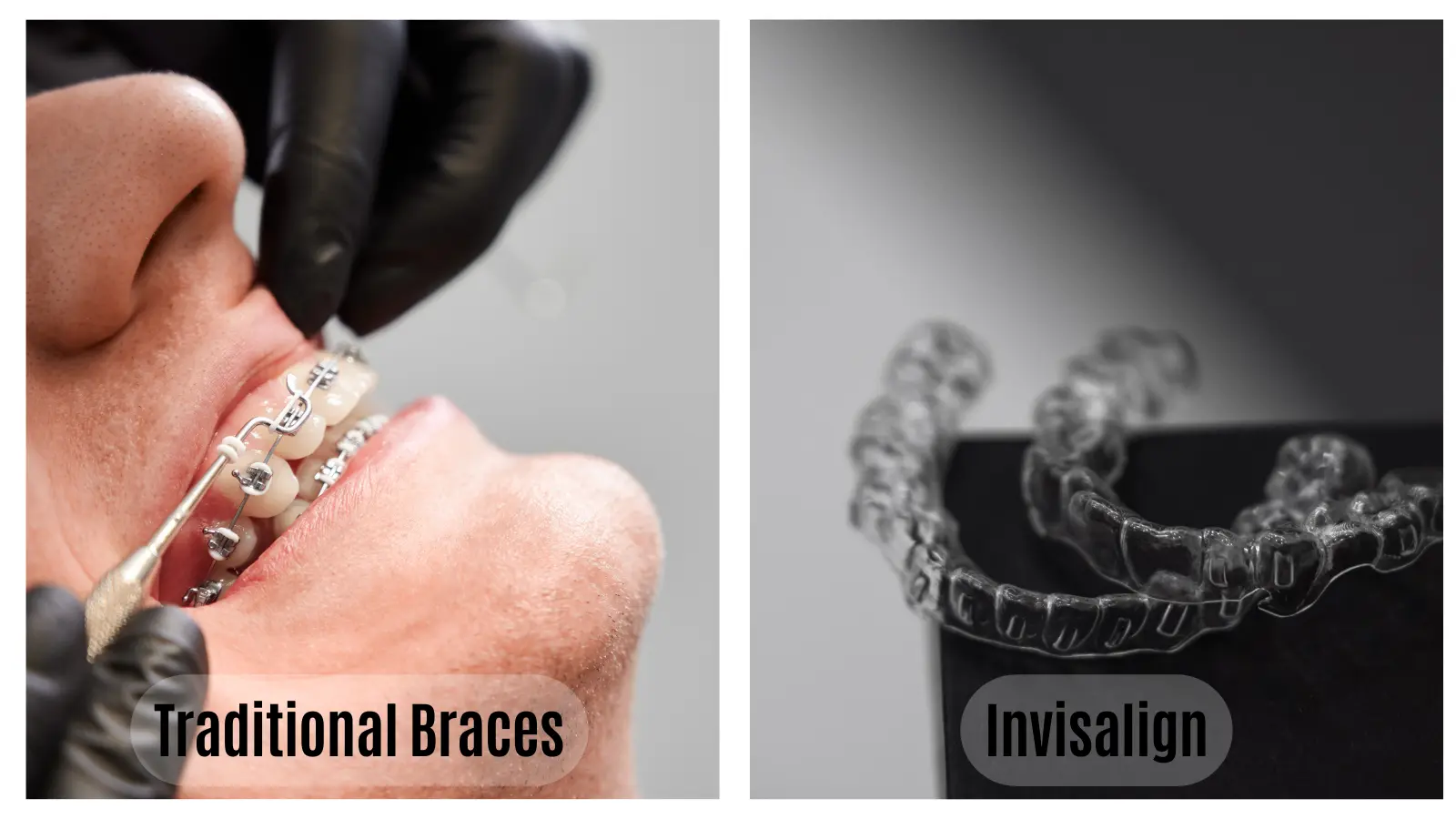What is Invisalign™, and How does it Work? Darley Dental Care of
