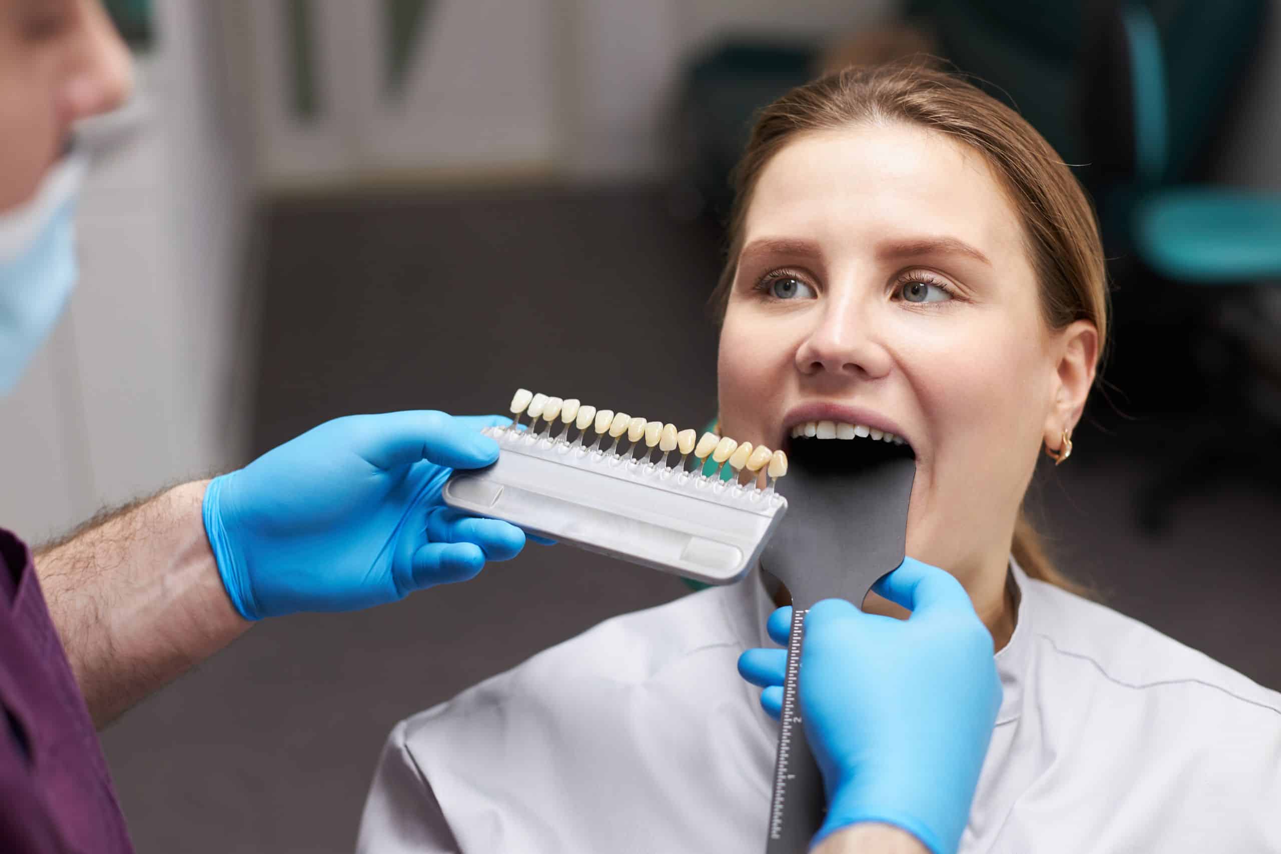 The woman is getting her veneers as the to fix her chipped teeth
