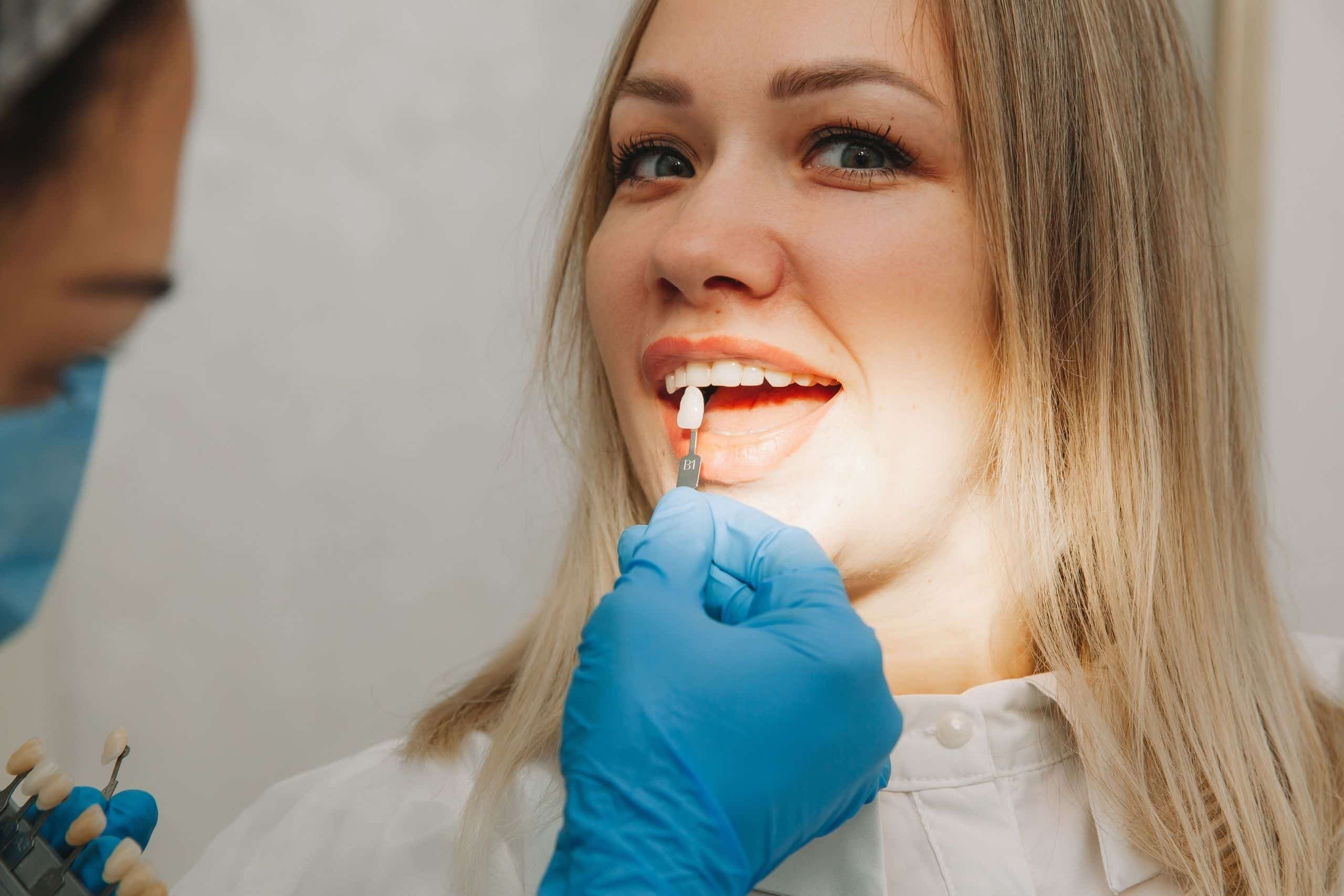 The dentist are checking the placement of dental veneers before placing them.