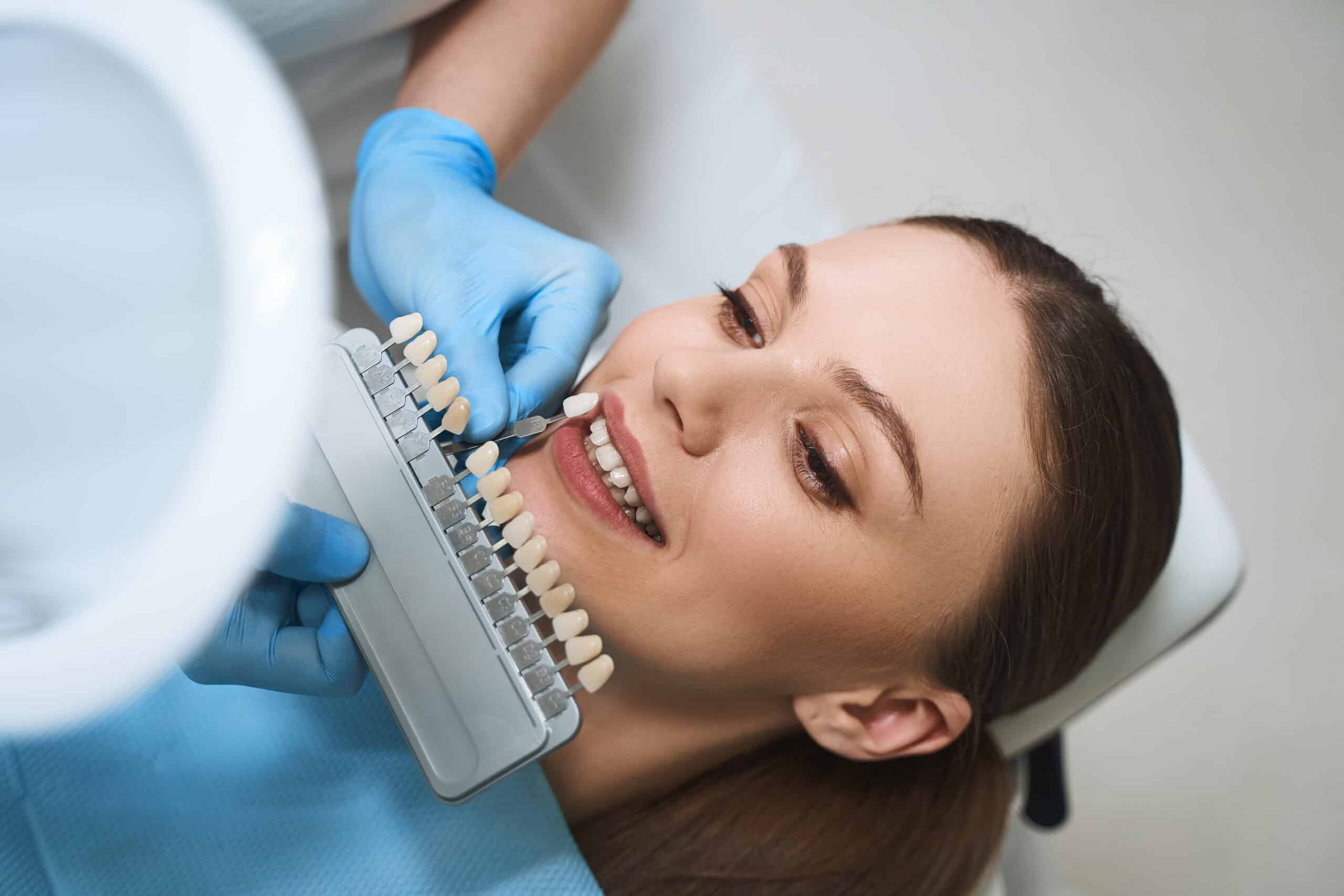 Veneers Altamonte Springs