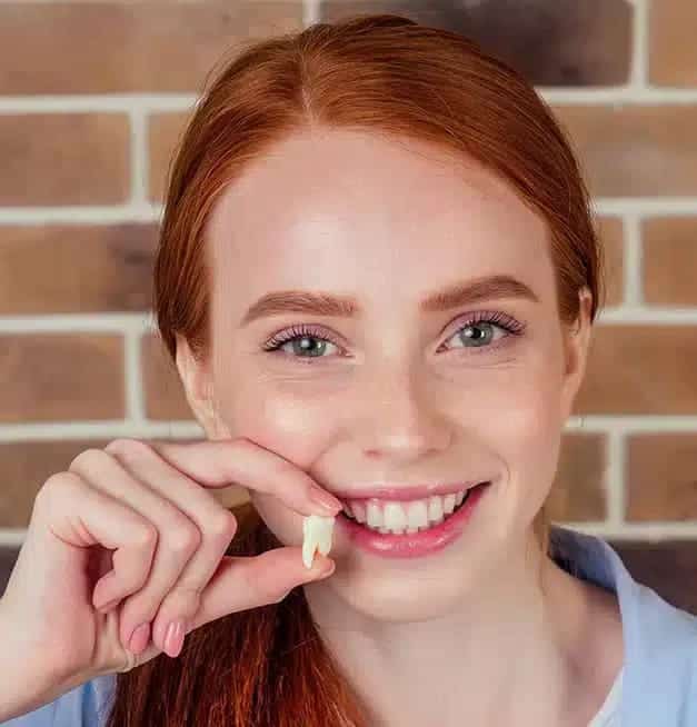 Woman after tooth extraction surgery procedure at Altamonte Springs